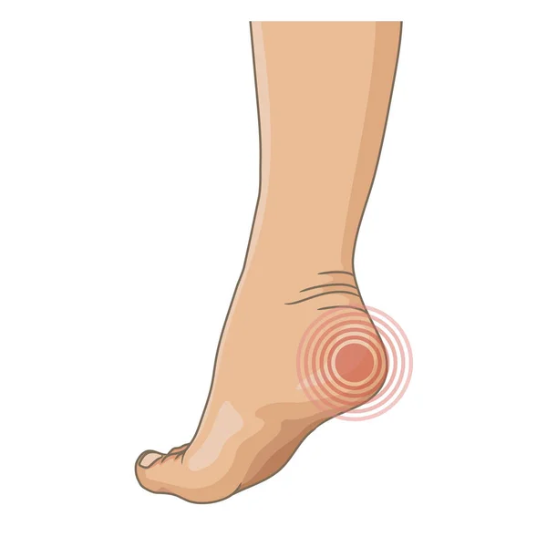 Female legs barefoot, side view. Vector illustration, hand drawn cartoon style isolated on white. — Stock Illustration Female Legs Barefoot Side View Vector Illustration Hand Drawn Cartoon Vector Graphics
