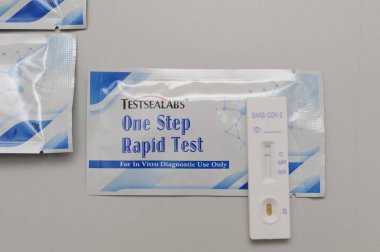 Bir tıp çalışanı Coronavirus COVID-19 için hızlı bir test yapar. Coronavirus kan testi gerçek..