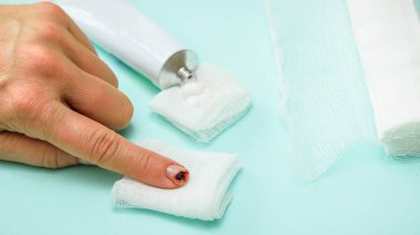 Bir bıçak kesim işaret parmağı ile sol el, bir tüp merhem ve mavi bir tablo üzerinde bir bandaj. Bir iç durum elinde zarar.