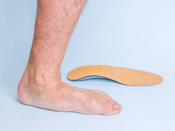 Ліва Нога Чоловіка Ознаками Міцних Плоских Ніг Ортопедичною Устілкою Синьому — стокове фото