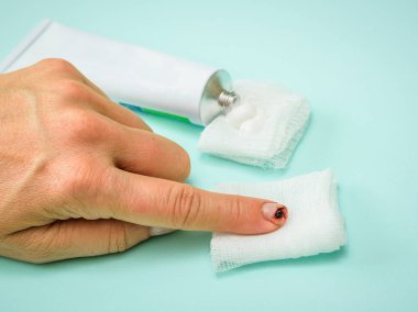 Şifa merhem ve mavi bir tabloda bir yaralı parmak açık tüp. Bir iç durum elinde zarar.
