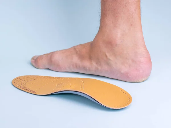 Ортопедична Устілка Правій Нозі Нозі Чоловіка Ознаками Плоских Ніг Синьому — стокове фото
