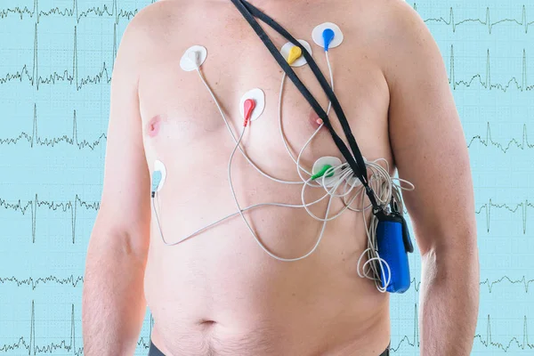 A man undergoes a heart examination on the background of a cardiogram. The method of the halter. — Stock Photo, Image