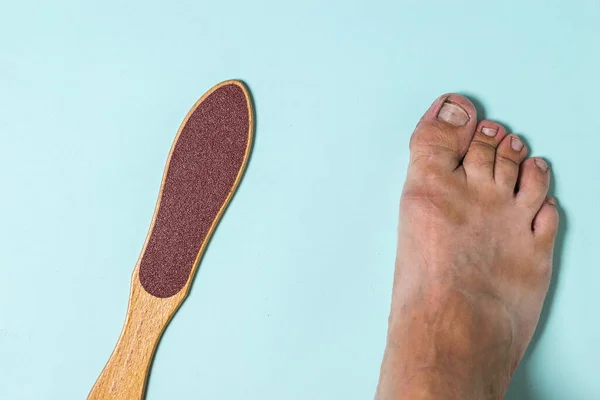 La pierna derecha del hombre y un dispositivo para limpiar la piel áspera . — Foto de Stock