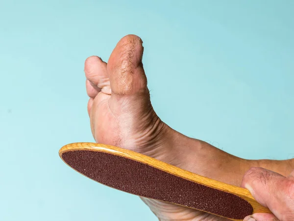 El hombre raspa la piel áspera de su pierna derecha . — Foto de Stock