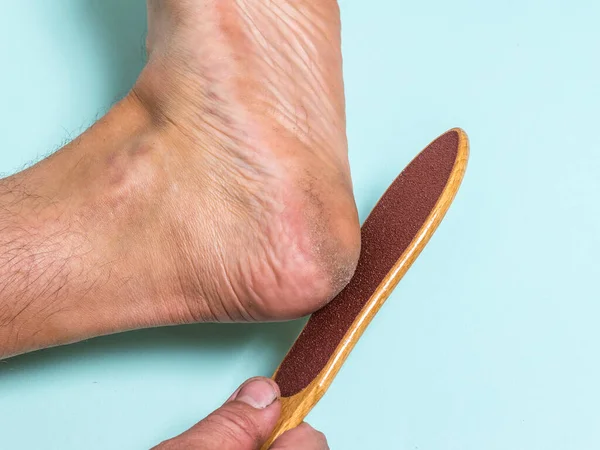 El hombre raspa la piel áspera del talón de su pie izquierdo . — Foto de Stock