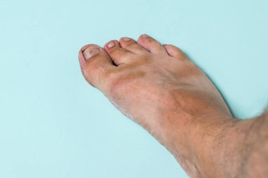 Mavi arka planda bir adamın çıplak sağ ayağı.