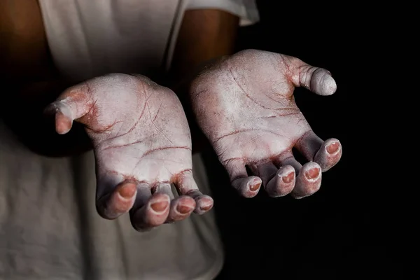 Fermez les mains du grimpeur avec du magnésium blanc prêt à grimper — Photo