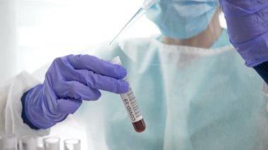 Laboratuvar asistanının ellerinde Coronavirus enfeksiyonu teşhisi için yapılan kan testlerinin laboratuvar örneği..