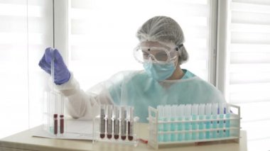 Covid-19 için kan testi. Kadın laboratuvar asistanı bir laboratuarda analiz yapar, test tüpleri ve pipet kullanır..