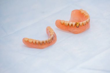 Kırık akrilik protez. Diş Hayaleti. Seçici odak fotoğrafı.