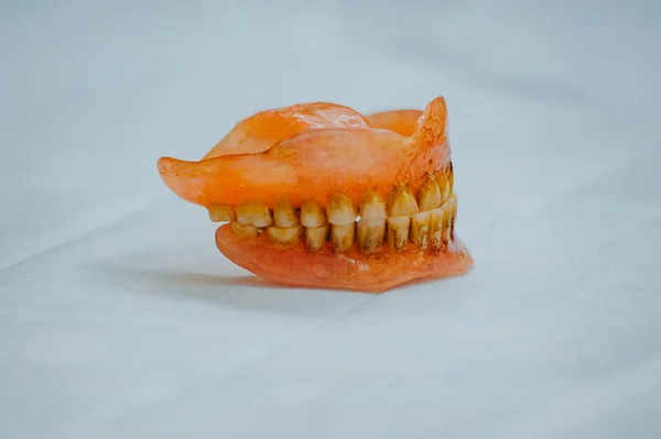 Prothèse Acrylique Cassée Fantôme Dentaire Photo Mise Point Sélective — Photo