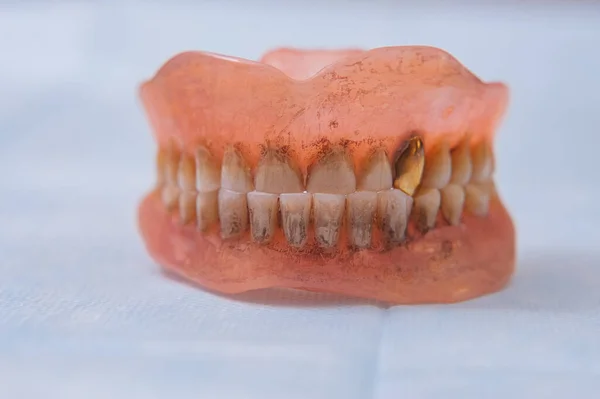 Σπασμένη Ακρυλική Οδοντοστοιχία Οδοντικό Φάντασμα Επιλογή Φωτογραφίας Εστίασης — Φωτογραφία Αρχείου