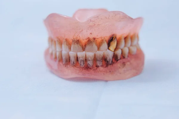 Broken Acrylic Denture Dental Phantom Selective Focus Photo — Stock Photo, Image