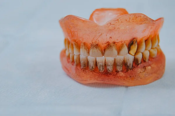 Broken Acrylic Denture Dental Phantom Selective Focus Photo — Stock Photo, Image