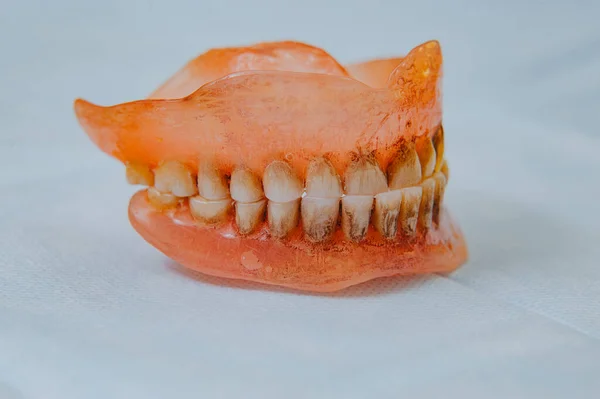 Dentadura Acrílica Partida Fantasma Dentário Foto Foco Seletivo — Fotografia de Stock