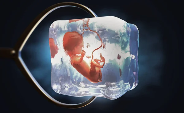 用金属钳子夹住冰冻的胎儿冷冻成冰立方的图示 — 图库照片