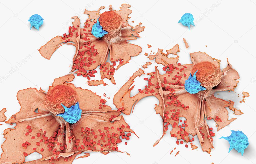 3d illustration of a cancer cell attacked and killed by lymphocytes