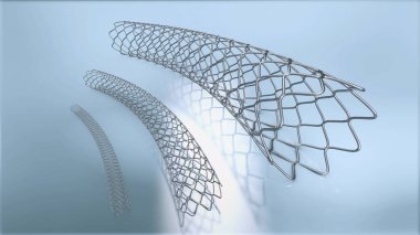 üç metal stent implantasyonu ve kan dolaşımı kan damarlarının içine desteklemek için 3D çizimi