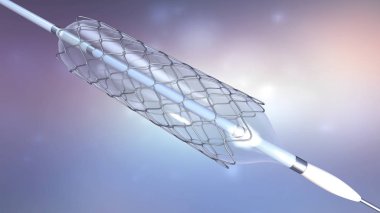 kan dolaşımı kan damarlarının içine desteklemek için stent implantasyonu 3D çizimi