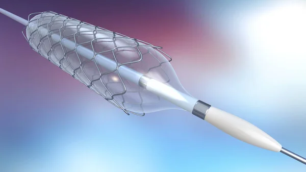 Ilustración Catéter Para Implantación Stent Para Apoyar Circulación Sanguínea Los —  Fotos de Stock