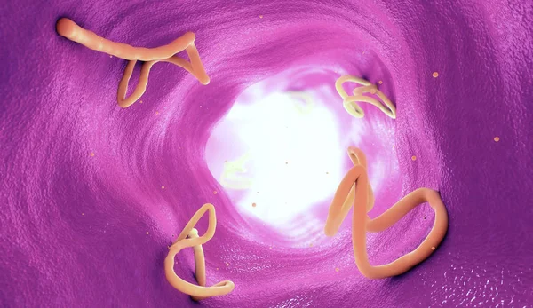 Ininfestazione da tenia in un intestino umano - Illustrazione 3d — Foto Stock