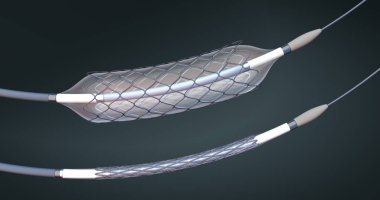 Boş ve dolu bir balon ile kan damarlarına implantasyon ve destek kan dolaşımı için stent ve kateter-3D illüstrasyon