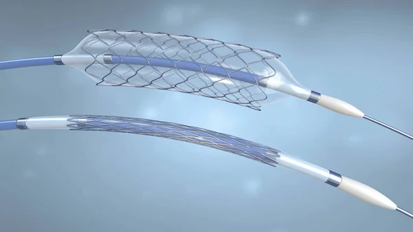 Boş ve dolu bir balon ile kan damarlarına implantasyon için stent ve kateter-3D illüstrasyon