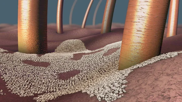 Primer plano microscópico de una infección fúngica de la capa superior de la piel —  Fotos de Stock