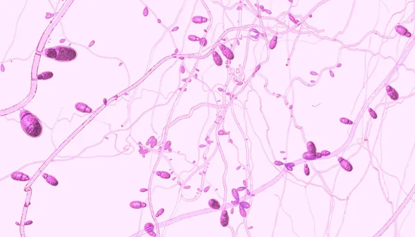 Κοντινό Πλάνο Της Καλλιέργειας Δερματοφύτων Μύκητα Που Προκαλεί Ασθένειες Του — Φωτογραφία Αρχείου