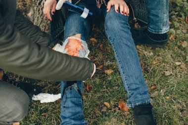 İki çocuk bacağından yaralanan bir kadına yardım ediyor.