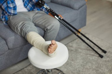 Young African American man relaxing with his foot resting on a stool while sitting with crutches on the sofa at home. Close up. Physical injury, accident, broken leg, fracture, treatment concept