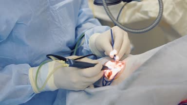 Doktor araçları, klinikte yakın çekim kullanarak insan gözü ameliyat