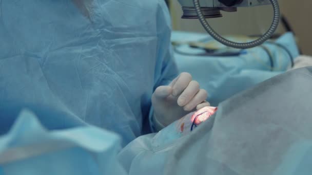 De chirurg bewerking een om te herstellen van de visie in een jonge patiënt — Stockvideo