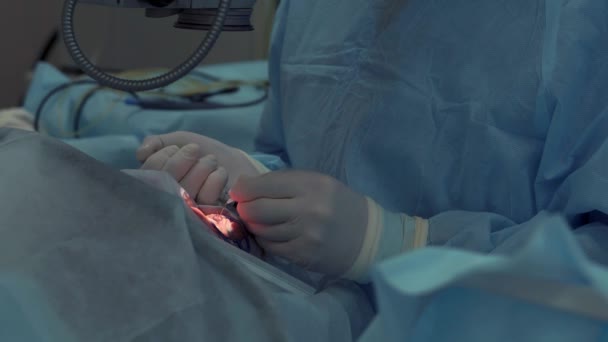 Руки хирурга во время операции на глазах человека, крупным планом — стоковое видео