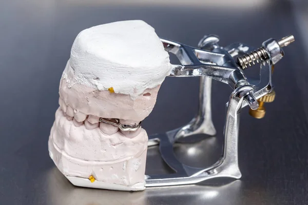 Molde Dientes Prótesis Dental Gris Modelo Encías Humanas Arcilla Laboratorio — Foto de Stock