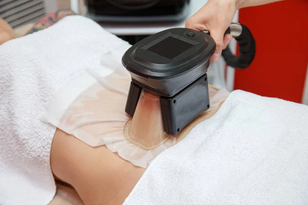 Donna Che Ottiene Procedura Trattamento Del Grasso Cryolipolysis Gabinetto Cosmetico — Foto Stock