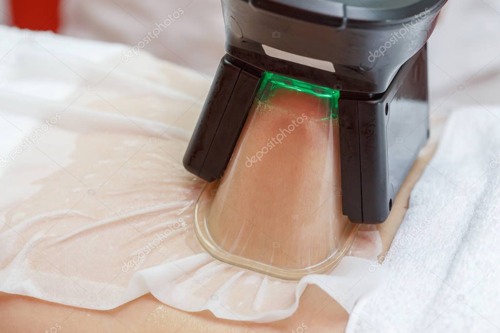 Woman getting cryolipolysis fat treatment procedure in professional cosmetic cabinet or spa center, closeup