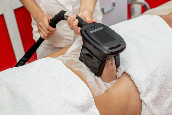 Kvinna Får Cryolipolysis Fett Behandlingsförfarandet Professionella Kosmetiska Skåp Eller Spa — Stockfoto