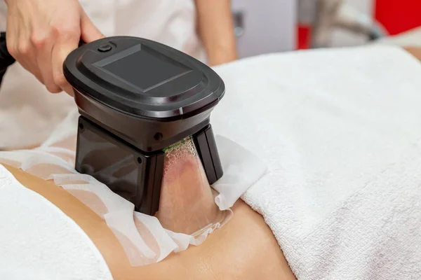 Kvinna Får Cryolipolysis Fett Behandlingsförfarandet Professionella Kosmetiska Skåp Eller Spa — Stockfoto