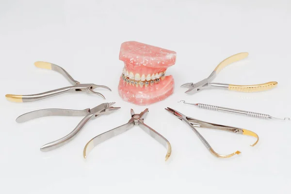 Modelo Ortodoncia Conjunto Herramientas Ortodoncia Metal Médico Sobre Fondo Claro —  Fotos de Stock