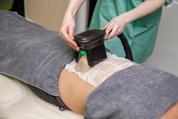 Žena Cryolipolysis Tuku Léčebného Postupu Profesionálních Kosmetických Kabinetu Nebo Wellness — Stock fotografie