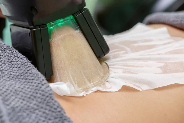 Γυναίκα Πάρει Cryolipolysis Λίπος Θεραπεία Διαδικασία Στο Επαγγελματικό Καλλυντικά Ντουλάπι — Φωτογραφία Αρχείου