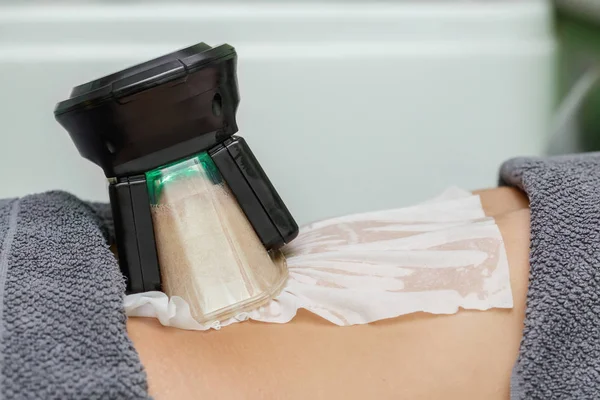 Cryolipolysis Frysa Fett Förfarande Kosmetiska Skåp Eller Spasalong Magen Närbild — Stockfoto