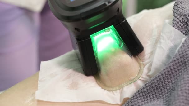 Vrouw Krijgt Cryolipolysis Vet Behandeling Procedure Professionele Cosmetische Kabinet Spa — Stockvideo