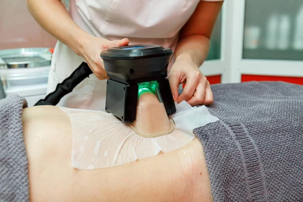 Güzellik terapisti cryolipolysis tedavisi uyguluyor. Cerrahi olmayan yağ azaltma