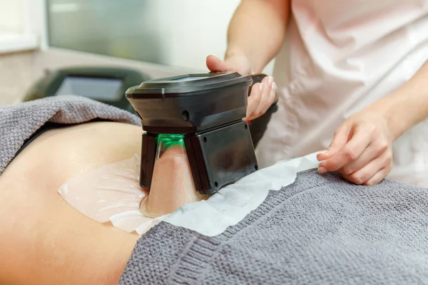 Güzellik terapisti cryolipolysis tedavisi uyguluyor. Cerrahi olmayan yağ azaltma