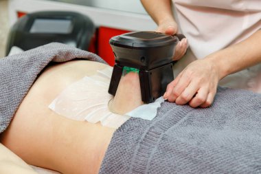 Güzellik terapisti cryolipolysis tedavisi uyguluyor. Cerrahi olmayan yağ azaltma