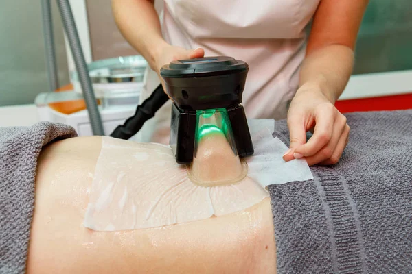 Pérdida de peso y tratamiento de criolipólisis adelgazante en el salón de belleza — Foto de Stock