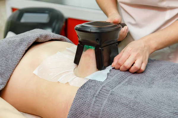 Güzellik terapisti cryolipolysis tedavisi uyguluyor. Cerrahi olmayan yağ azaltma